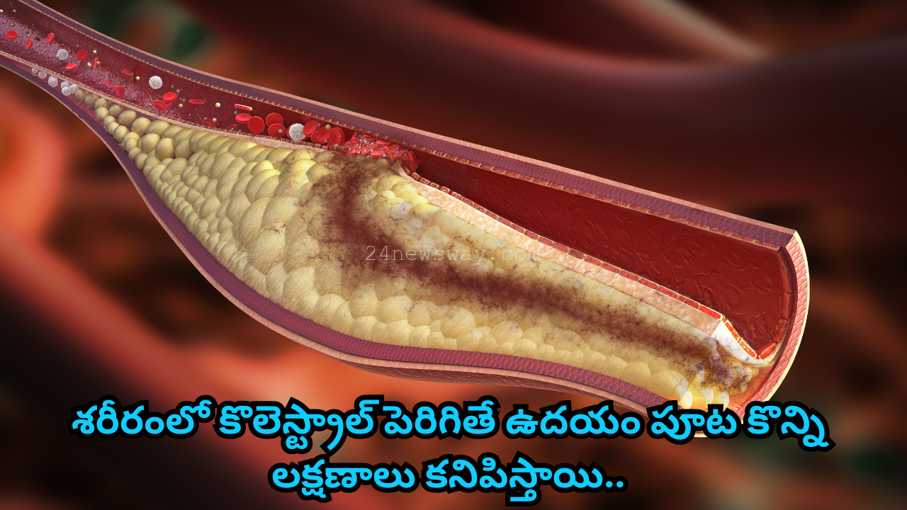 Symptoms of cholesterol in the body