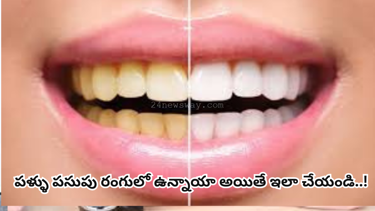 teeth are yellow how to make them white
