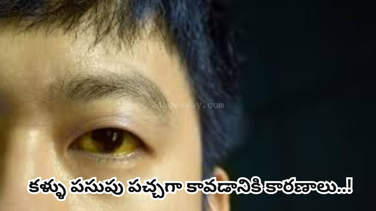 Reasons why eyes turn yellow..!