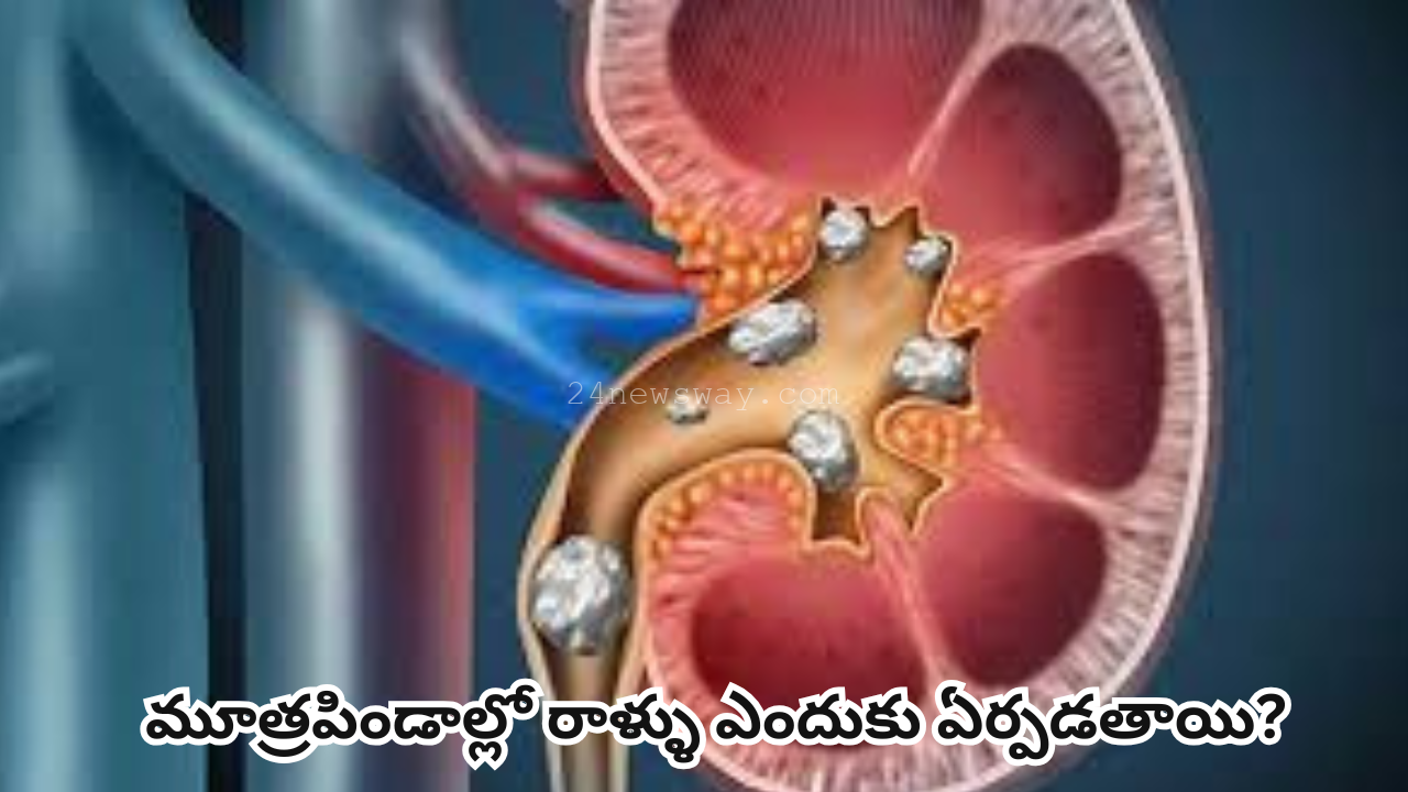 why do kidney stones form