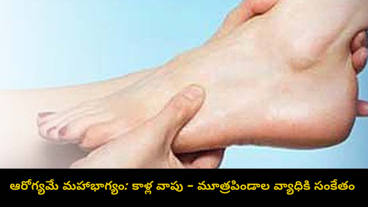 Leg swelling due to CKD – Chronic Kidney Disease symptom