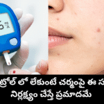 diabetes skin symptoms due to high blood sugar