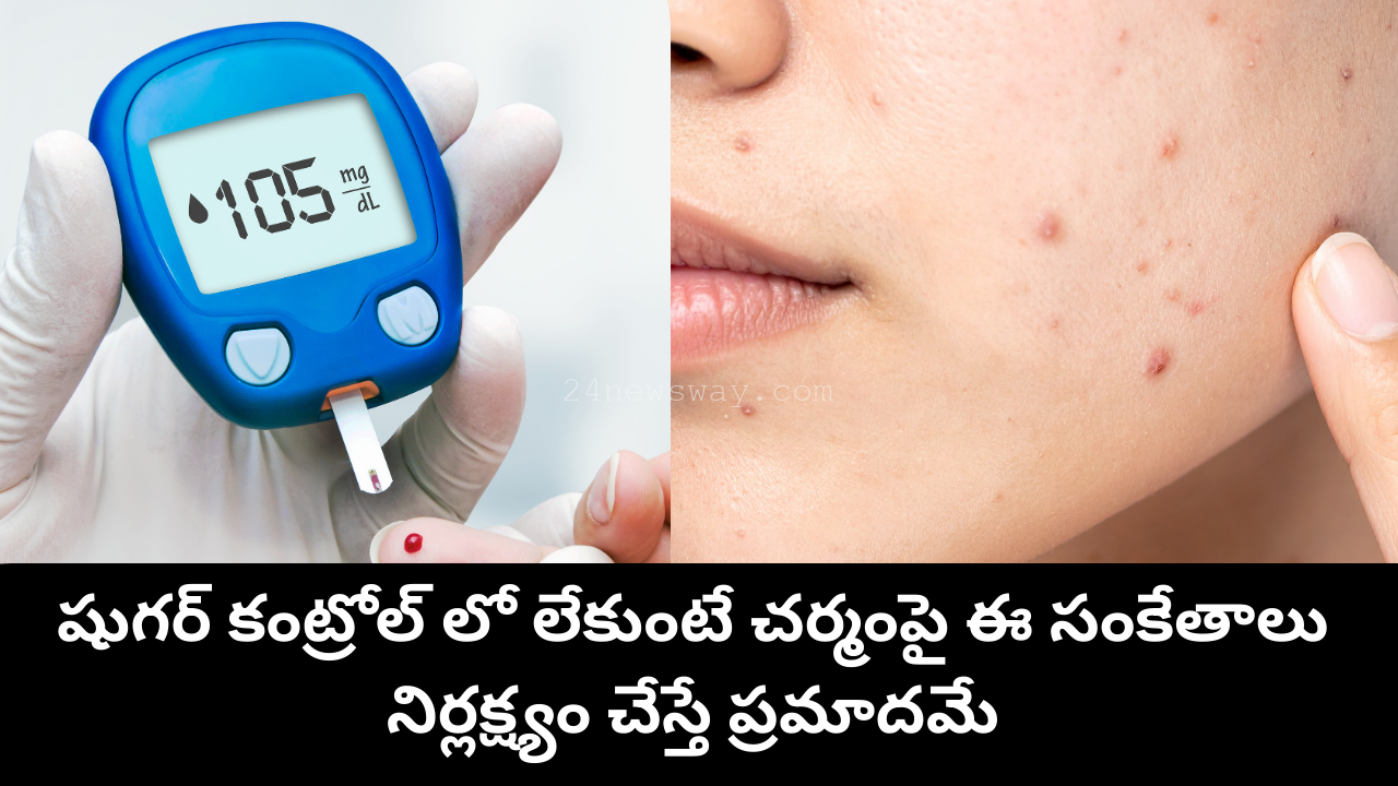 diabetes skin symptoms due to high blood sugar